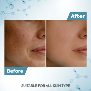 Tan removal cream before & after