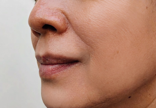 Brightening Serum Over 30: Addressing Pigmentation and Early Fine Lines